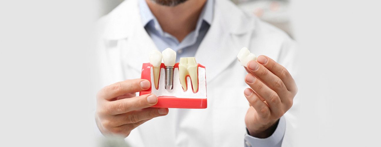 3 Ways Dental Implants Improve Quality of Life