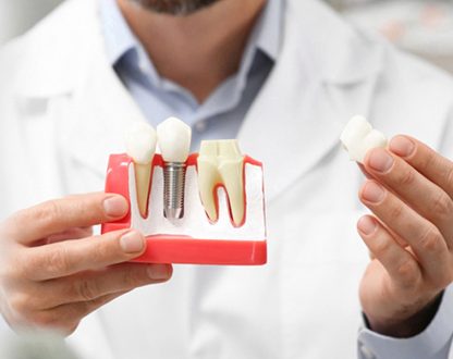 3 Ways Dental Implants Improve Quality of Life