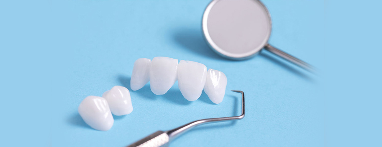 Dental Veneers in Richmond, TX, Dental Veneers Near me
