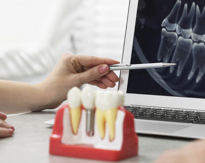 Why Elegant Dental Richmond Is the Top Choice for Dental Implants in Richmond, TX