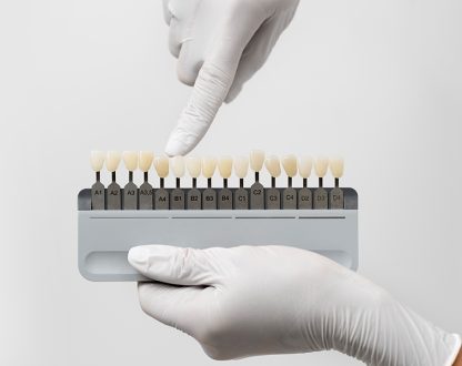 Discover the Magic of Veneers at Elegant Dental in Richmond, TX