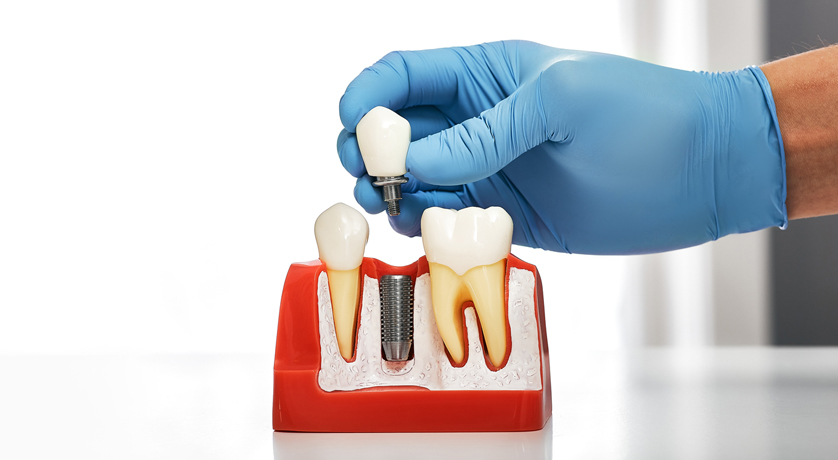 Dental