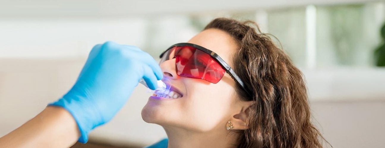Common Myths About Teeth Whitening in Richmond, TX – Busted!