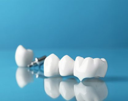 Dental Crowns in Sugar Land, TX, Dental Crowns near you