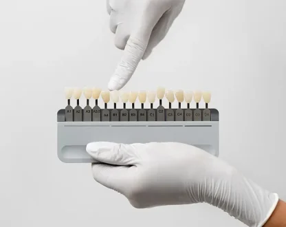 Considering Veneers in Richmond, TX? Read This Before You Spend a Dollar